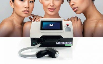 A technological revolution in laser hair removal