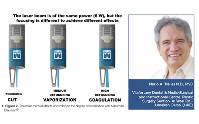 EVALUATION OF A HIGH-POWER BLUE DIODE LASER (MILESMANBLAUMAN®) FOR DERMAESTHETIC TREATMENTS.